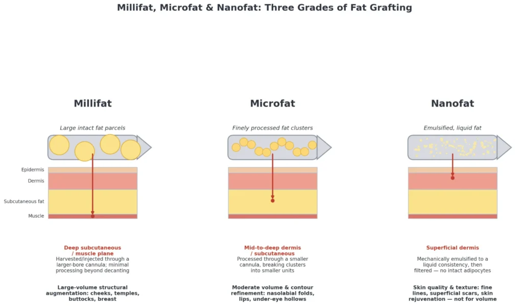 Millifat, Microfat and Nanofat: Three Grades of Fat Grafting